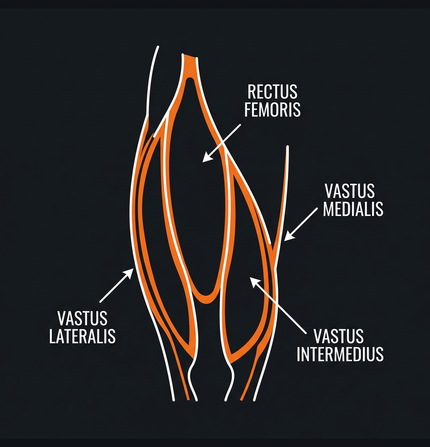 Diagram illustrating key concepts from Quad-Dominant Leg Hypertrophy Program